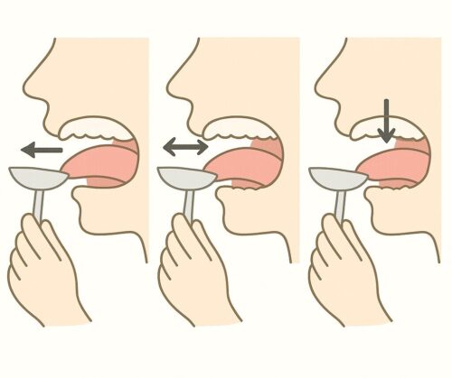 舌圧トレーニングの方法をイラストで説明している。