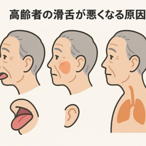 高齢者の滑舌が悪くなる原因を示す断面図。口・舌・頬・喉の筋肉が衰えて発音が不明瞭になる様子を色分けで表した医療資料風イラスト。