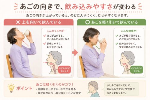 上を向いて飲む状態と、あごを軽く引いて飲む状態を比較し、あごの向きで飲み込みやすさとむせやすさが変わることを示したイラスト。